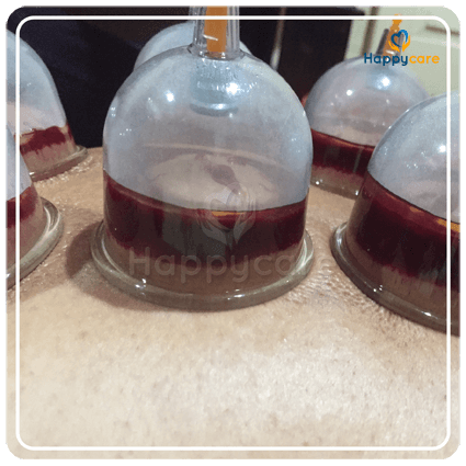Rumah Bekam Happycare 017